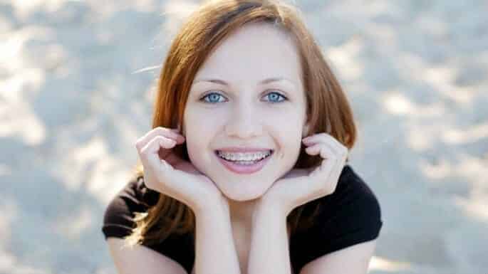 metal vs ceramic braces