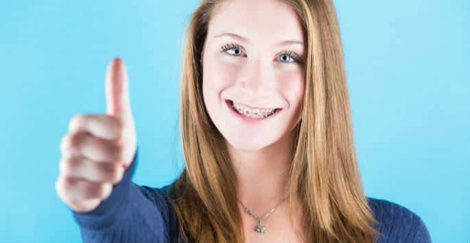 Braces