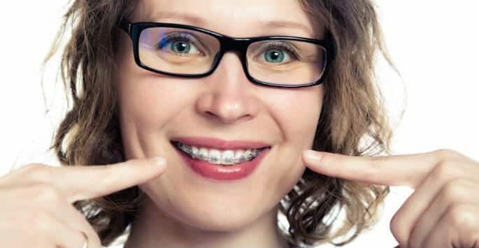 Braces for Adults