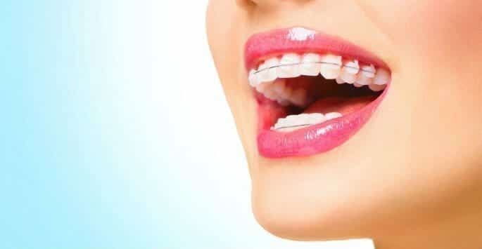 Teeth Hurt After Braces