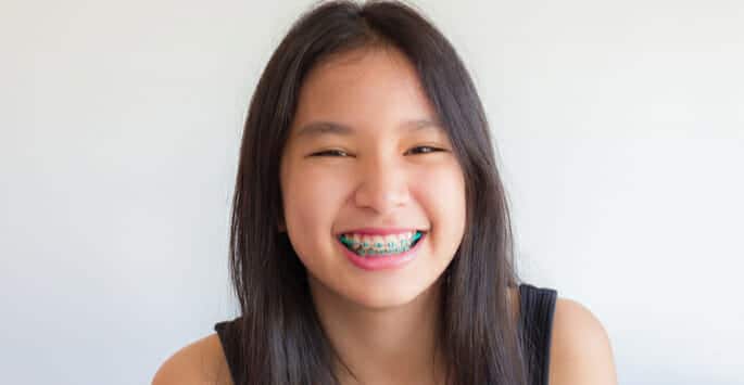 braces