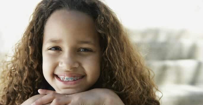braces