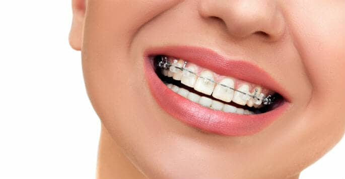 Gum health