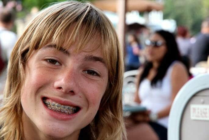Teen braces in Niceville