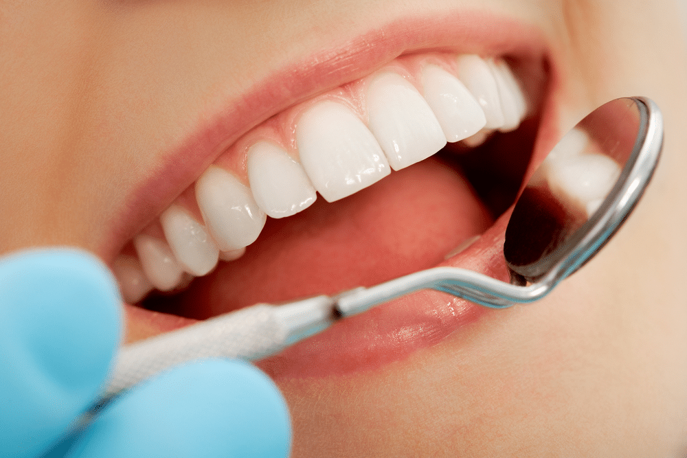 ceramic braces