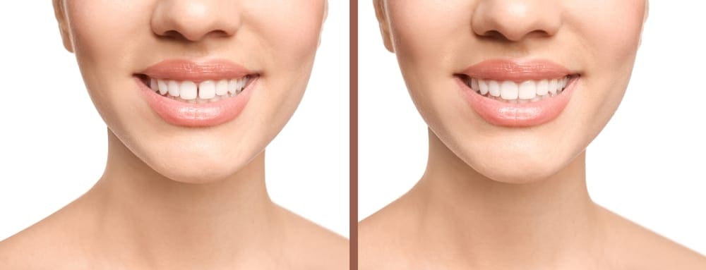The Difference Between a Dentist and Orthodontist | Brodie Bowman Orthodontics